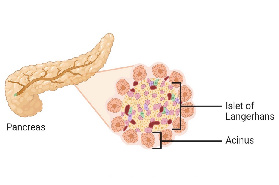 Diagram showing how the functions of beta cells in the pancreas become compromised at each stage of diabetes. 